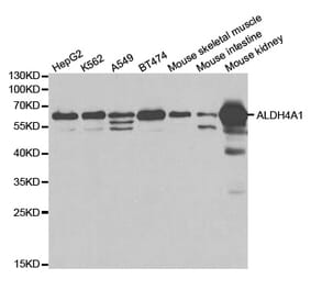 Western blot - ALDH4A1 Antibody from Signalway Antibody (32742) - Antibodies.com