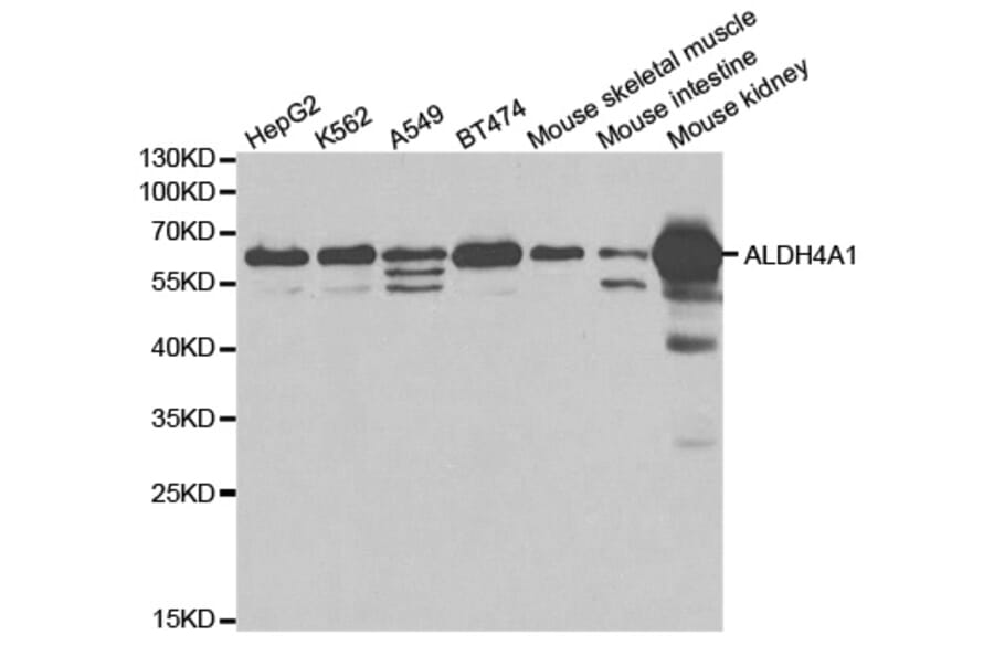 Western blot - ALDH4A1 Antibody from Signalway Antibody (32742) - Antibodies.com