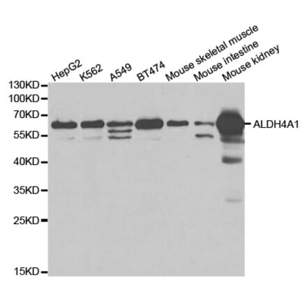 Western blot - ALDH4A1 Antibody from Signalway Antibody (32742) - Antibodies.com