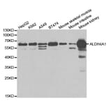 Western blot - ALDH4A1 Antibody from Signalway Antibody (32742) - Antibodies.com
