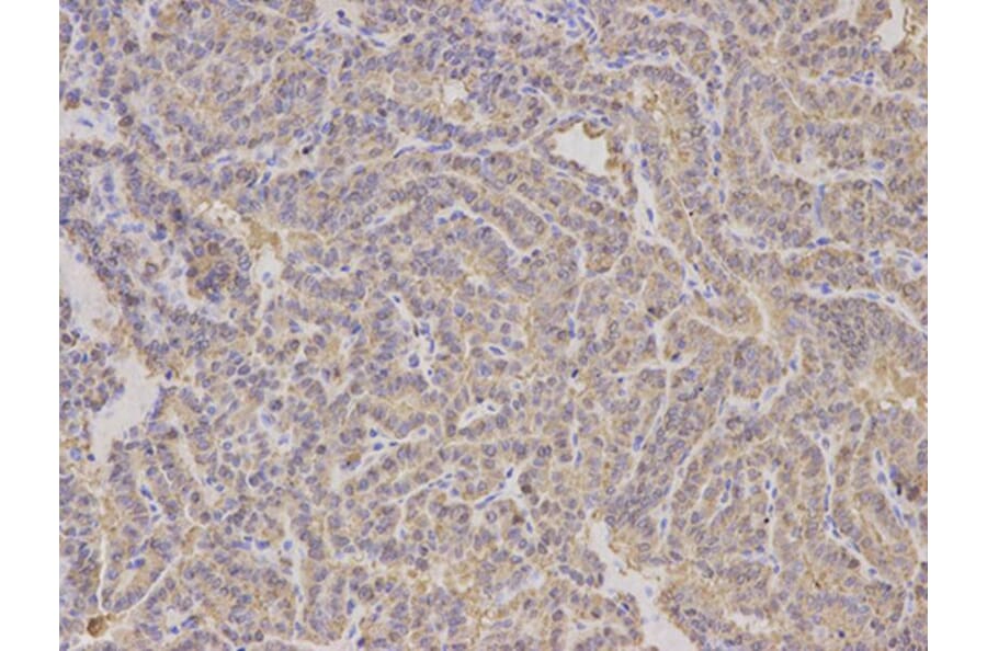 Immunohistochemistry - ALDH4A1 Antibody from Signalway Antibody (32742) - Antibodies.com