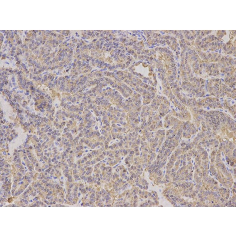 Immunohistochemistry - ALDH4A1 Antibody from Signalway Antibody (32742) - Antibodies.com