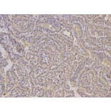 Immunohistochemistry - ALDH4A1 Antibody from Signalway Antibody (32742) - Antibodies.com