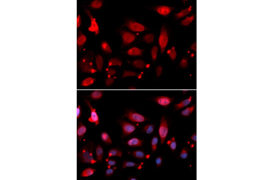 Immunofluorescence - RACGAP1 Antibody from Signalway Antibody (32752) - Antibodies.com