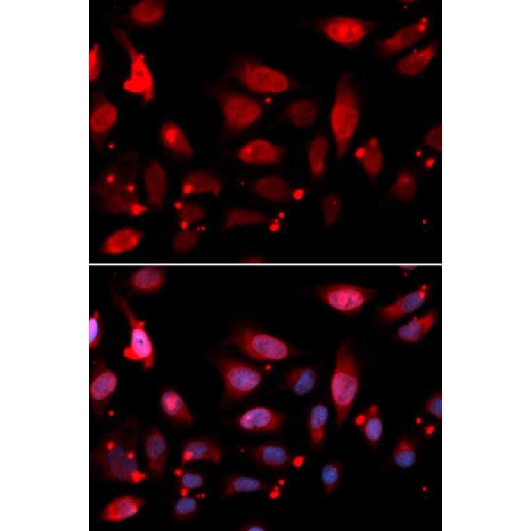 Immunofluorescence - RACGAP1 Antibody from Signalway Antibody (32752) - Antibodies.com