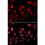 Immunofluorescence - RACGAP1 Antibody from Signalway Antibody (32752) - Antibodies.com