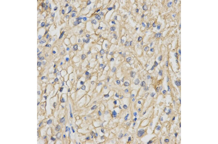 Immunohistochemistry - RACGAP1 Antibody from Signalway Antibody (32752) - Antibodies.com