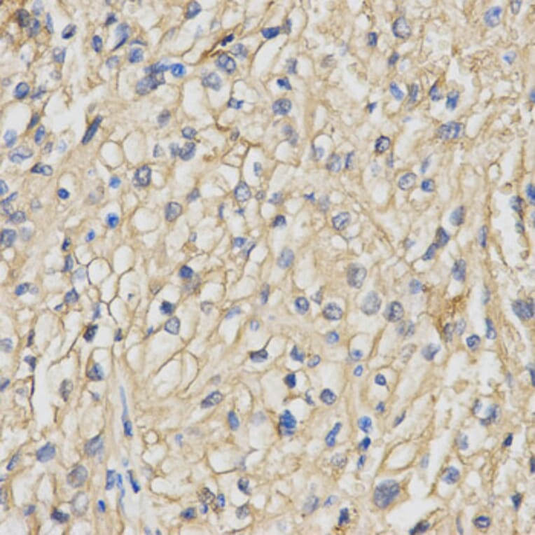 Immunohistochemistry - RACGAP1 Antibody from Signalway Antibody (32752) - Antibodies.com