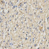 Immunohistochemistry - RACGAP1 Antibody from Signalway Antibody (32752) - Antibodies.com