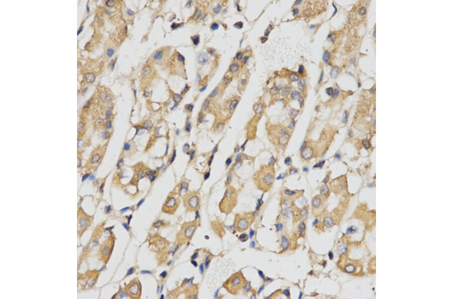 Immunohistochemistry - RACGAP1 Antibody from Signalway Antibody (32752) - Antibodies.com
