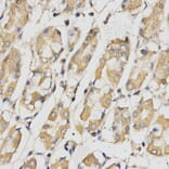 Immunohistochemistry - RACGAP1 Antibody from Signalway Antibody (32752) - Antibodies.com