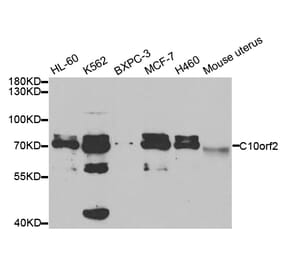 Western blot - C10orf2 Antibody from Signalway Antibody (32757) - Antibodies.com
