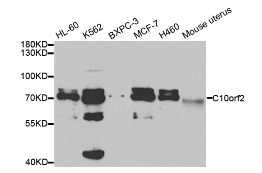 Western blot - C10orf2 Antibody from Signalway Antibody (32757) - Antibodies.com