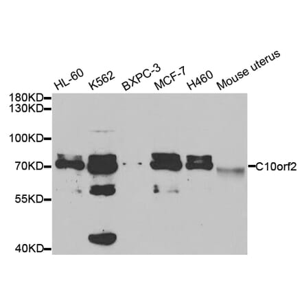 Western blot - C10orf2 Antibody from Signalway Antibody (32757) - Antibodies.com