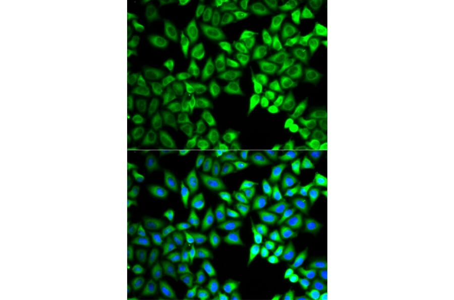Immunofluorescence - C10orf2 Antibody from Signalway Antibody (32757) - Antibodies.com