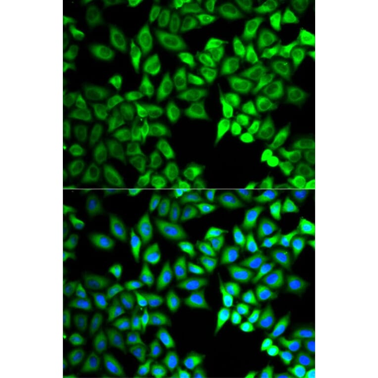 Immunofluorescence - C10orf2 Antibody from Signalway Antibody (32757) - Antibodies.com