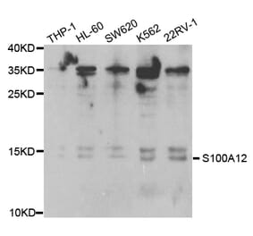 Western blot - S100A12 Antibody from Signalway Antibody (32775) - Antibodies.com