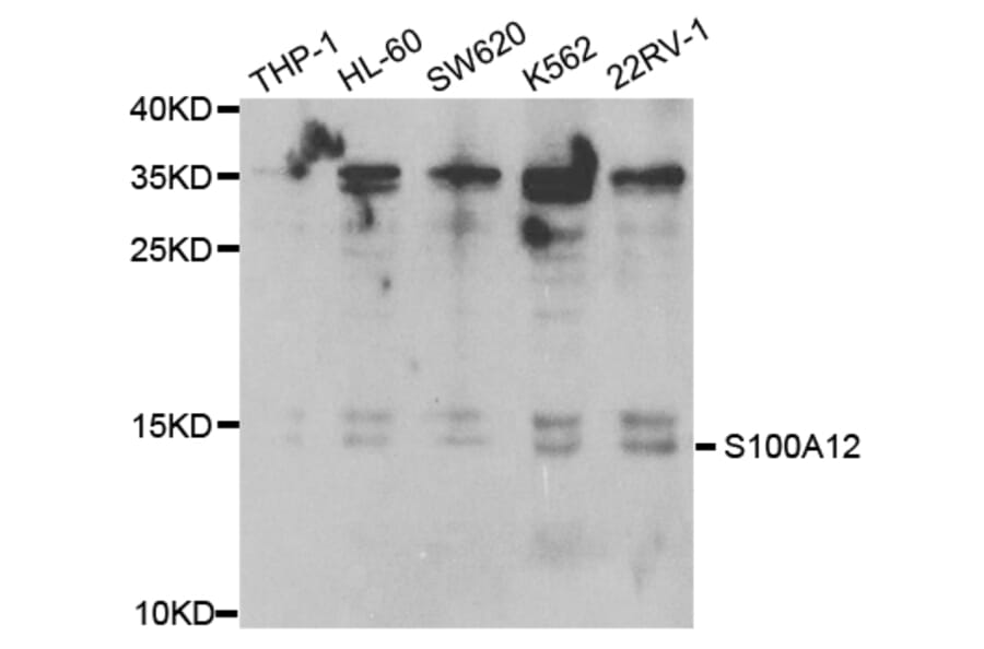 Western blot - S100A12 Antibody from Signalway Antibody (32775) - Antibodies.com