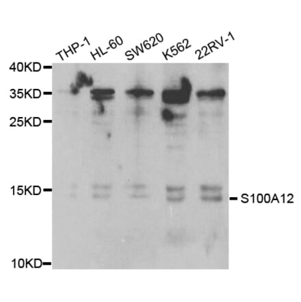 Western blot - S100A12 Antibody from Signalway Antibody (32775) - Antibodies.com