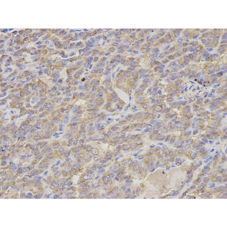 Immunohistochemistry - S100A12 Antibody from Signalway Antibody (32775) - Antibodies.com