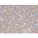 Immunohistochemistry - S100A12 Antibody from Signalway Antibody (32775) - Antibodies.com