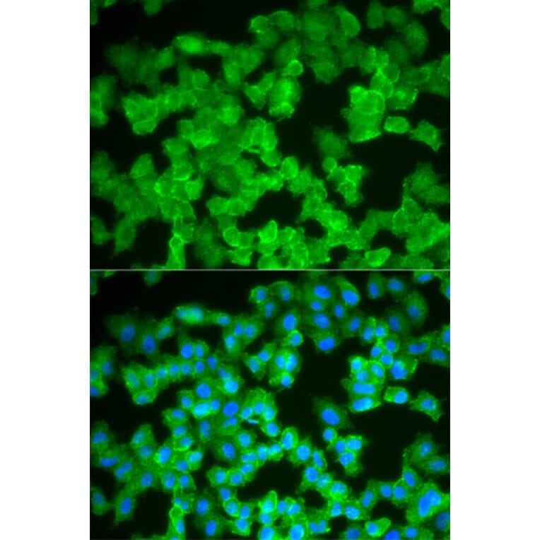 Immunofluorescence - S100A12 Antibody from Signalway Antibody (32775) - Antibodies.com