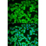 Immunofluorescence - S100A12 Antibody from Signalway Antibody (32775) - Antibodies.com