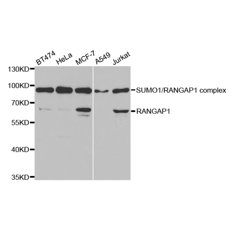 Western blot - RANGAP1 Antibody from Signalway Antibody (32818) - Antibodies.com