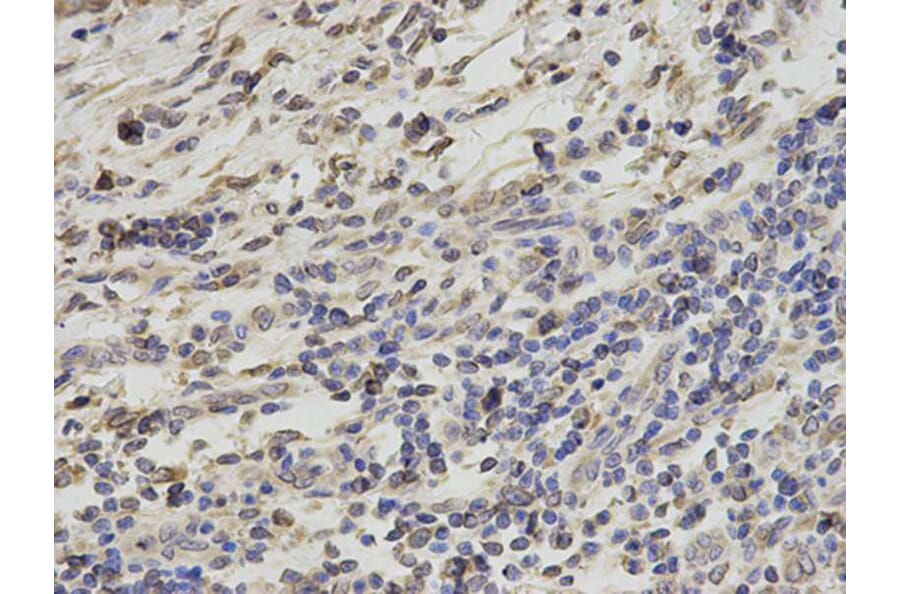 Immunohistochemistry - RANGAP1 Antibody from Signalway Antibody (32818) - Antibodies.com