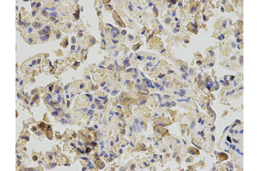 Immunohistochemistry - RANGAP1 Antibody from Signalway Antibody (32818) - Antibodies.com