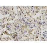 Immunohistochemistry - RANGAP1 Antibody from Signalway Antibody (32818) - Antibodies.com