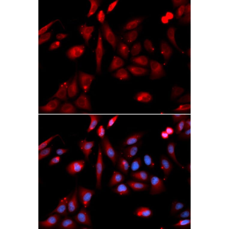 Immunofluorescence - RANGAP1 Antibody from Signalway Antibody (32818) - Antibodies.com