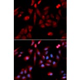 Immunofluorescence - RANGAP1 Antibody from Signalway Antibody (32818) - Antibodies.com