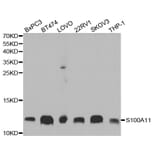 Western blot - S100A11 Antibody from Signalway Antibody (32881) - Antibodies.com