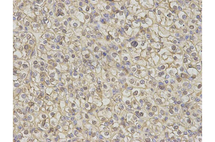 Immunohistochemistry - S100A11 Antibody from Signalway Antibody (32881) - Antibodies.com