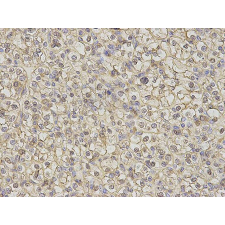 Immunohistochemistry - S100A11 Antibody from Signalway Antibody (32881) - Antibodies.com