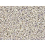 Immunohistochemistry - S100A11 Antibody from Signalway Antibody (32881) - Antibodies.com