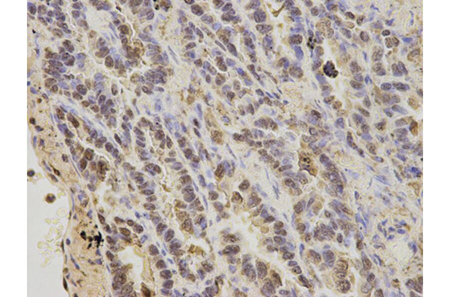 Immunohistochemistry - S100A11 Antibody from Signalway Antibody (32881) - Antibodies.com