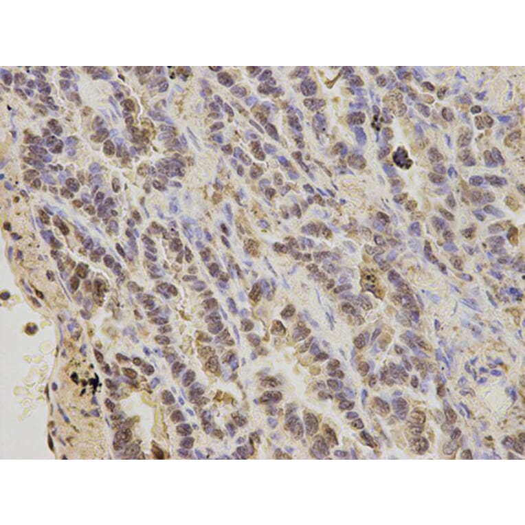 Immunohistochemistry - S100A11 Antibody from Signalway Antibody (32881) - Antibodies.com