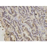 Immunohistochemistry - S100A11 Antibody from Signalway Antibody (32881) - Antibodies.com