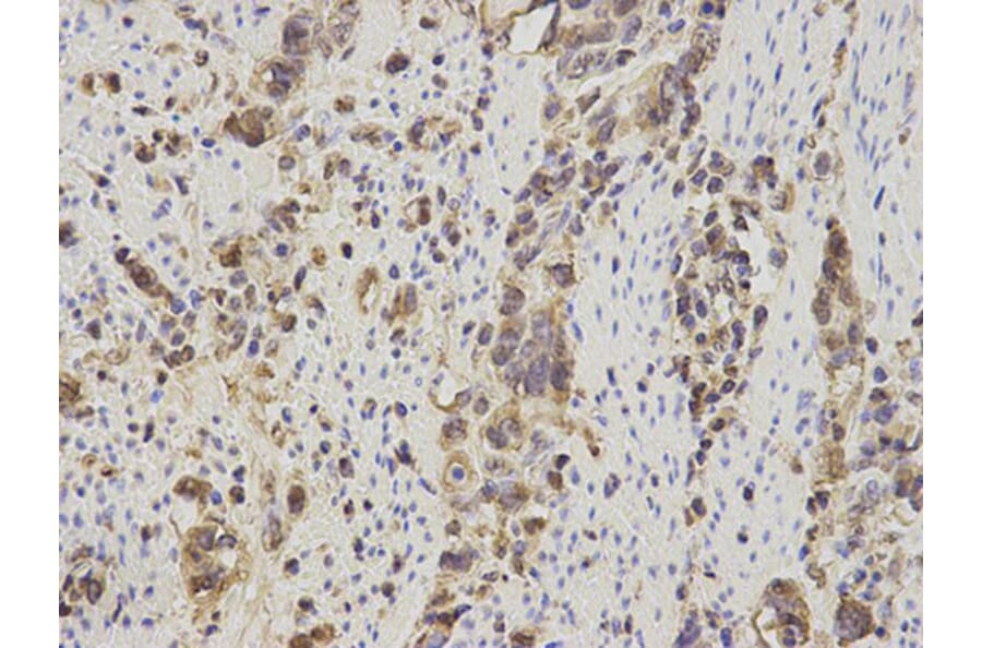 Immunohistochemistry - S100A11 Antibody from Signalway Antibody (32881) - Antibodies.com