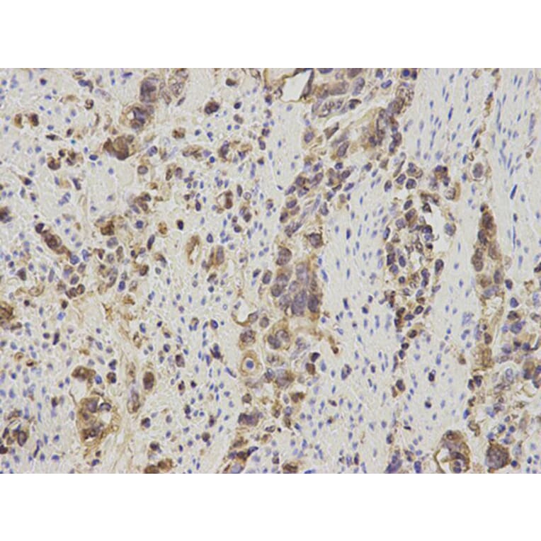 Immunohistochemistry - S100A11 Antibody from Signalway Antibody (32881) - Antibodies.com