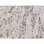 Immunohistochemistry - S100A11 Antibody from Signalway Antibody (32881) - Antibodies.com
