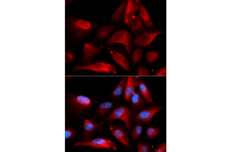 Immunofluorescence - S100A11 Antibody from Signalway Antibody (32881) - Antibodies.com