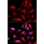 Immunofluorescence - S100A11 Antibody from Signalway Antibody (32881) - Antibodies.com