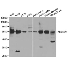 Western blot - ALDH3A1 Antibody from Signalway Antibody (32892) - Antibodies.com