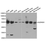 Western blot - ALDH3A1 Antibody from Signalway Antibody (32892) - Antibodies.com