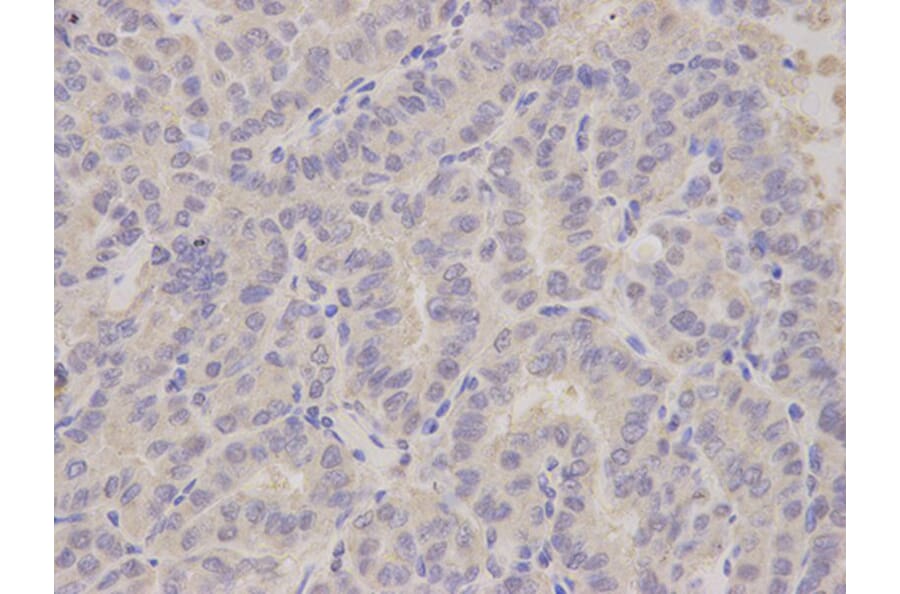Immunohistochemistry - ALDH3A1 Antibody from Signalway Antibody (32892) - Antibodies.com