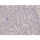 Immunohistochemistry - ALDH3A1 Antibody from Signalway Antibody (32892) - Antibodies.com