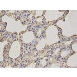 Immunohistochemistry - ALDH3A1 Antibody from Signalway Antibody (32892) - Antibodies.com
